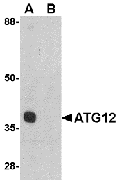 Anti ATG12 (Internal Region) Antibody gallery image 1