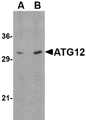 Anti ATG12 (N-Terminal) Antibody gallery image 1