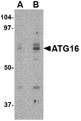 Anti ATG16 (Internal Region) Antibody gallery image 1