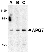 Anti Human ATG7 (C-Terminal) Antibody gallery image 1
