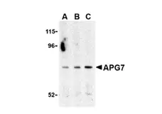 Anti Human ATG7 (C-Terminal) Antibody gallery image 1