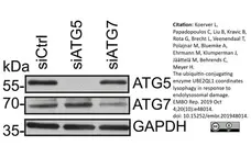 Anti Human ATG7 (C-Terminal) Antibody gallery image 3