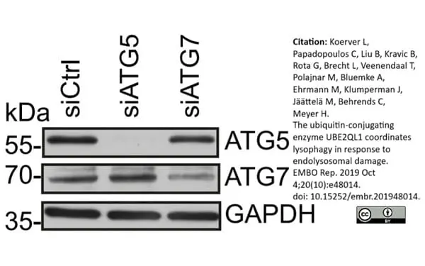 Anti Human ATG7 (C-Terminal) Antibody gallery image 3