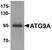 Anti ATG9A Antibody thumbnail image 1