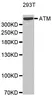 Anti ATM Antibody thumbnail image 1