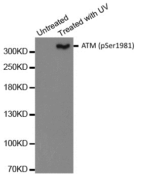 Anti ATM (pSer1981) Antibody thumbnail image 1