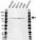 Anti ATP2A3 Antibody (PrecisionAb Polyclonal Antibody) thumbnail image 1
