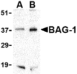 Anti BAG1 (C-Terminal) Antibody gallery image 1
