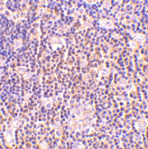 Anti BAG1 (N-Terminal) Antibody gallery image 2