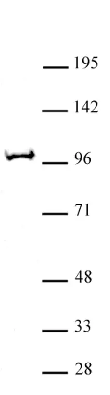 Anti Human BAP1 Antibody gallery image 1