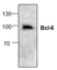 Anti Bcl-6 Antibody thumbnail image 1