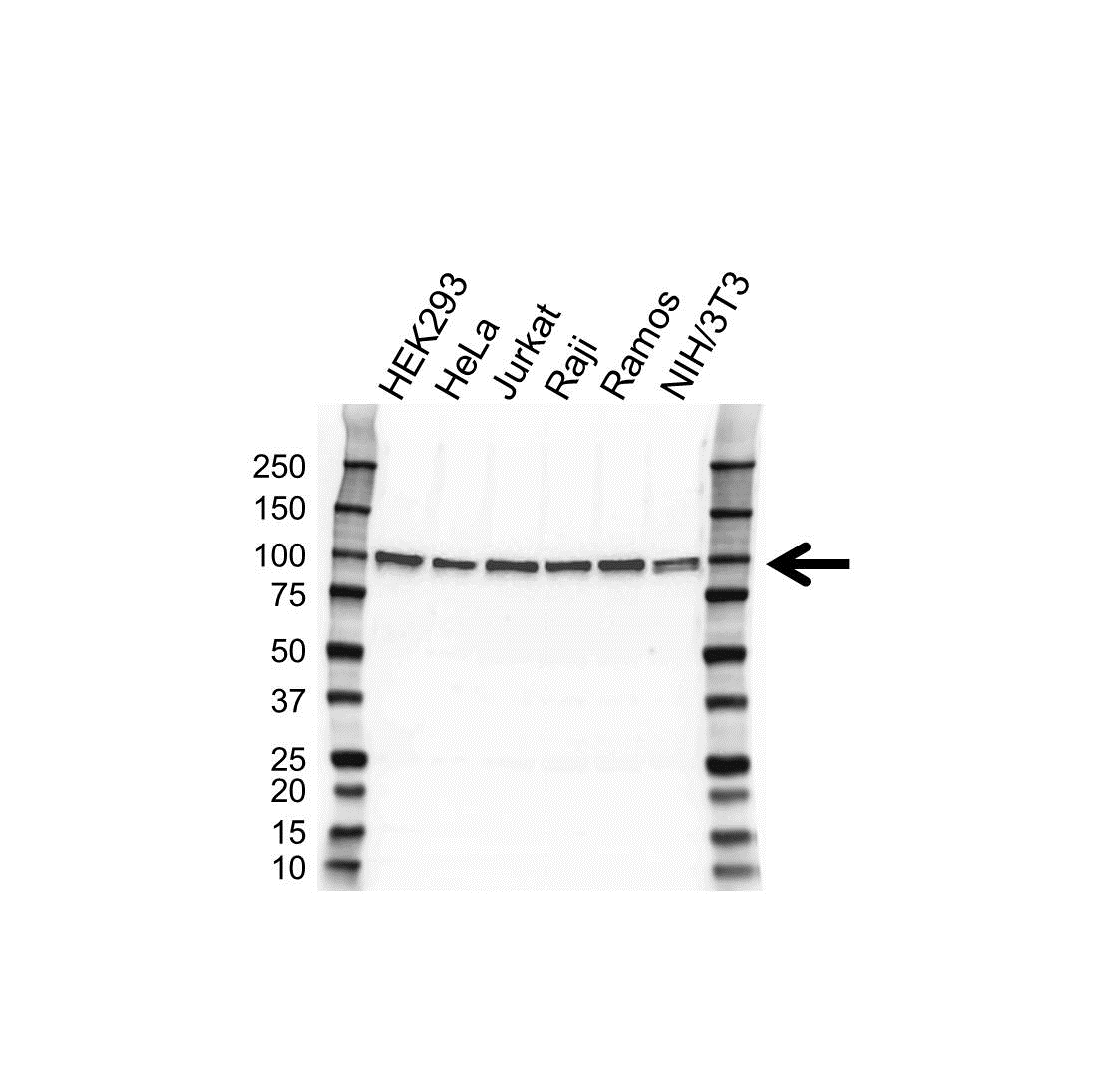 Anti Bcl-6 Antibody (PrecisionAb Polyclonal Antibody) gallery image 1