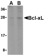 Anti Human Bcl-xL Antibody gallery image 1