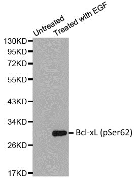 Anti Bcl-xL (pSer62) Antibody gallery image 1