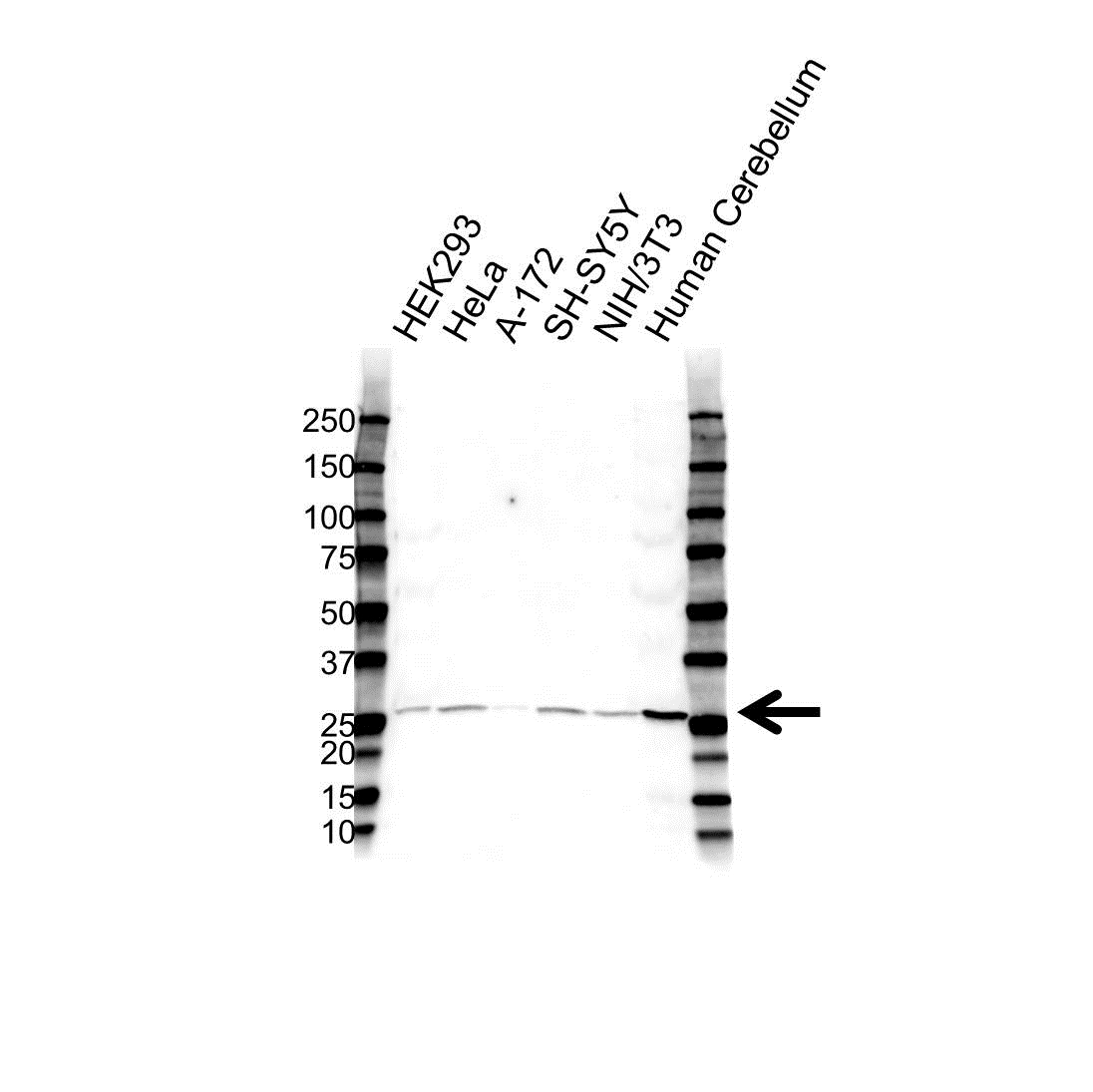 Anti BDNF Antibody (PrecisionAb Polyclonal Antibody) gallery image 1