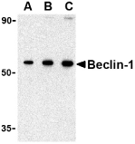 Anti Beclin-1 (N-Terminal) Antibody thumbnail image 1