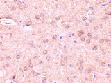 Anti Beclin-1 (N-Terminal) Antibody gallery image 2