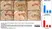 Anti Human Beta Amyloid (aa1-42) Antibody thumbnail image 1