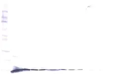 Anti Human BETA-NGF Antibody gallery image 1