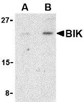 Anti BIK (N-Terminal) Antibody gallery image 1