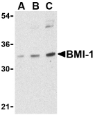 Anti BMI-1 Antibody gallery image 1
