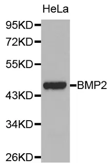 Anti BMP-2 Antibody gallery image 1