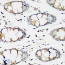 Anti BMP-2 Antibody gallery image 2