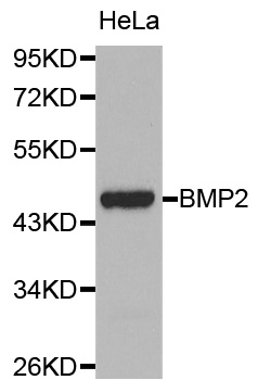 Anti BMP-2 Antibody gallery image 1
