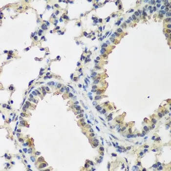 Anti BMP-2 Antibody gallery image 3