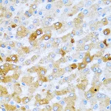 Anti BMP-2 Antibody gallery image 4