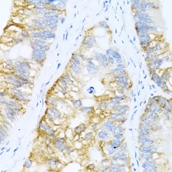 Anti BMP-2 Antibody gallery image 5