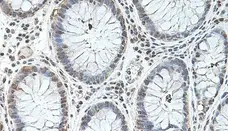 Anti Human BMP-2 Antibody gallery image 1