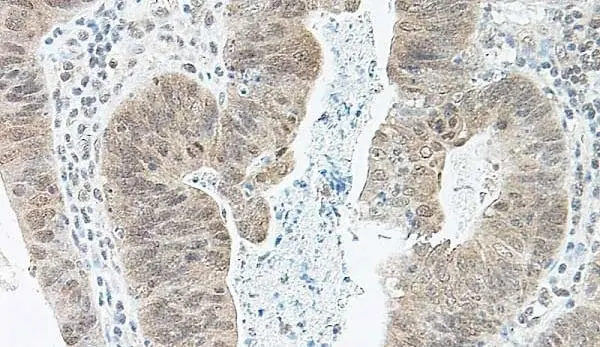Anti Human BMP-2 Antibody gallery image 2