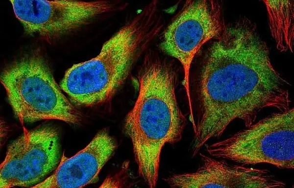Anti Human BMP-2 Antibody gallery image 3