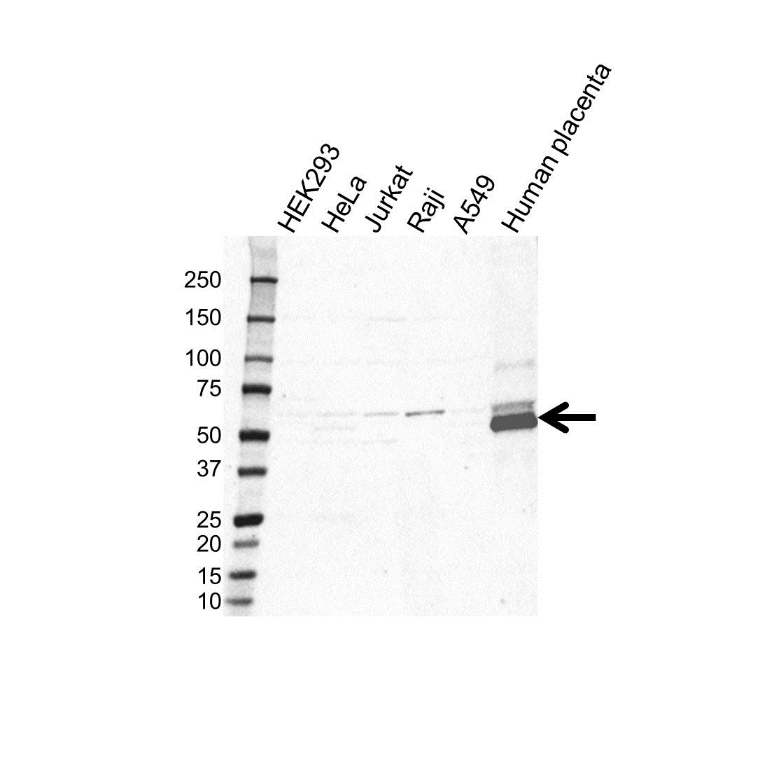 Anti BMP-6 Antibody (PrecisionAb Polyclonal Antibody) gallery image 1