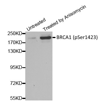 Anti BRCA1 (pSer1423) Antibody gallery image 1