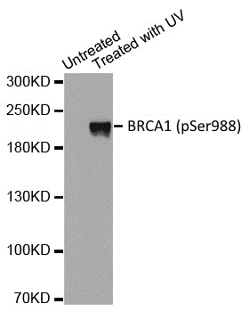 Anti BRCA1 (pSer988) Antibody gallery image 1