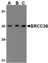 Anti BRCC36 Antibody gallery image 1