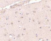 Anti BRCC36 Antibody thumbnail image 2