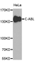 Anti C-ABL Antibody thumbnail image 1