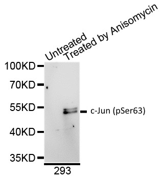 Anti c-Jun (pSer63) Antibody gallery image 1