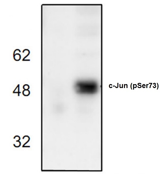 Anti c-Jun (pSer73) Antibody gallery image 1