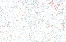 Anti Human C4d Antibody gallery image 1