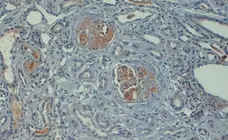 Anti Human C4d Antibody gallery image 2