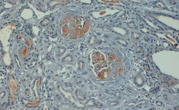 Anti Human C4d Antibody gallery image 2