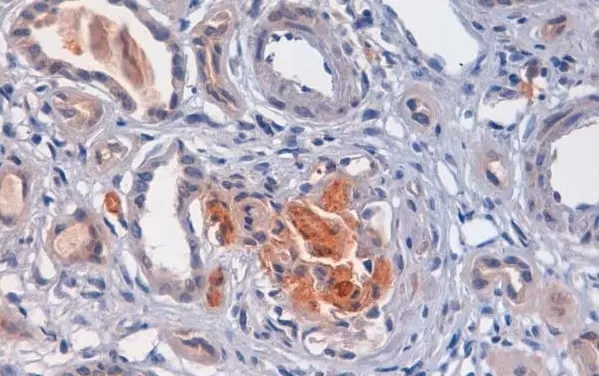 Anti Human C4d Antibody gallery image 3