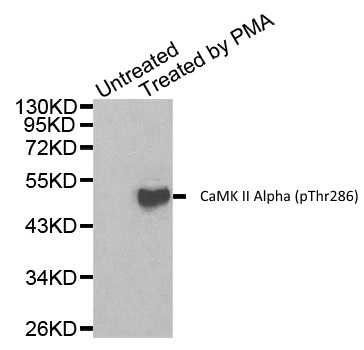 Anti CaMK II Alpha (pThr286) Antibody gallery image 1