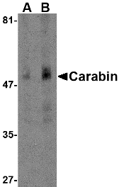 Anti Carabin (N-Terminal) Antibody gallery image 1