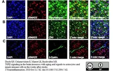 Anti Human Carbonic Anhydrase II Antibody gallery image 1