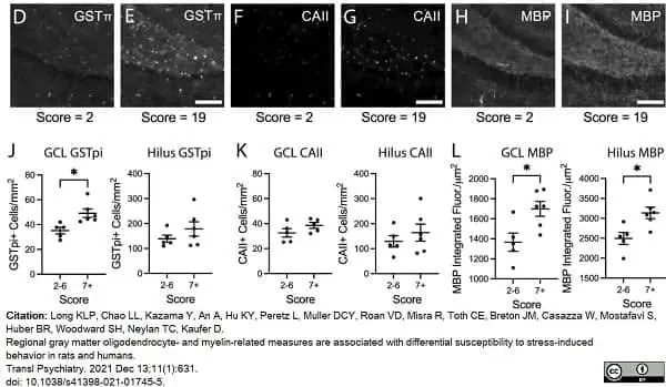 Anti Human Carbonic Anhydrase II Antibody gallery image 3